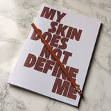 'My Skin Does Not Define Me' Notebook - Skin Positivity, Rosacea Awareness