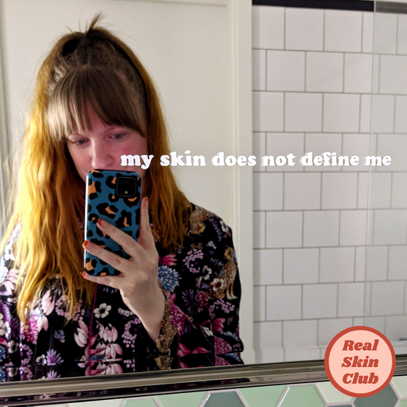 'My Skin Does Not Define Me' Mirror Sticker